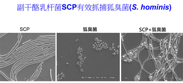 副干酪乳杆菌SCP有效防治狐臭